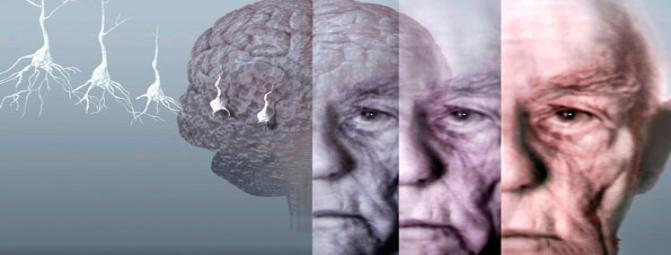 تاثیر تغذیه بر آلزایمر